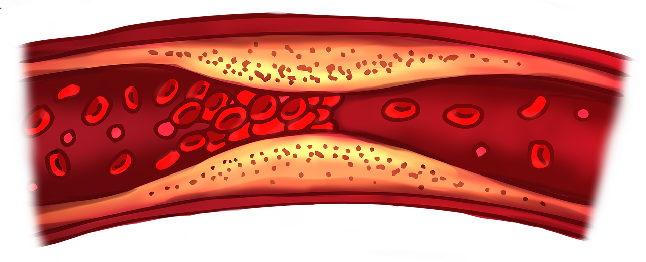 Cholesterol